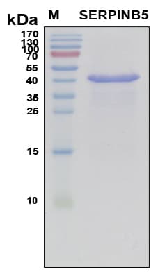Human SERPINB5 / Maspin Protein (Recombinant 6His, N-terminus)