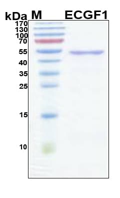 Human TP / Thymidine Phosphorylase Protein (Recombinant 6His, N-terminus)