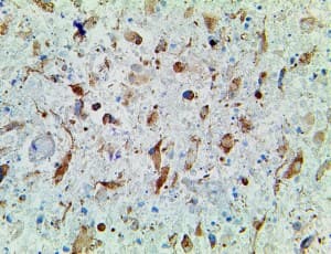 IDH1 / IDH Antibody (clone IHC132)