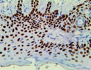 TP63 / p63 Antibody (clone 4A4)