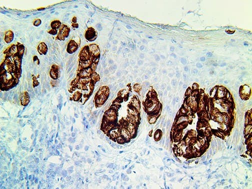 EPCAM Antibody (clone Ber-EP4, Ready-to-Use)