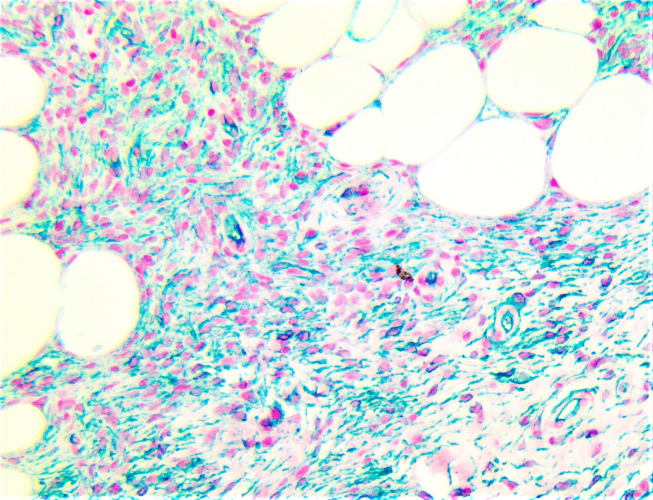 Monoclonal Mouse anti-Human CD34 Antibody (clone QBEnd/10, Ready-to-Use, IHC)