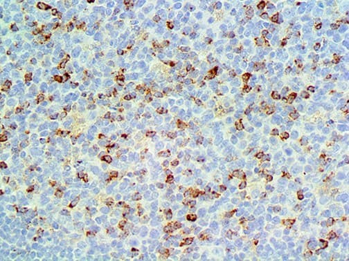 Monoclonal Mouse anti-Human CTLA4 / CD152 Antibody (IHC)