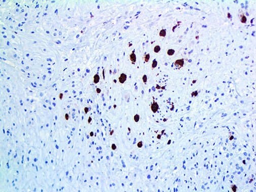 Monoclonal Mouse anti-Human MB / Myoglobin Antibody (IHC)