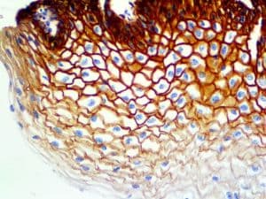 EPCAM Antibody (clone EP11, Ready-to-Use)