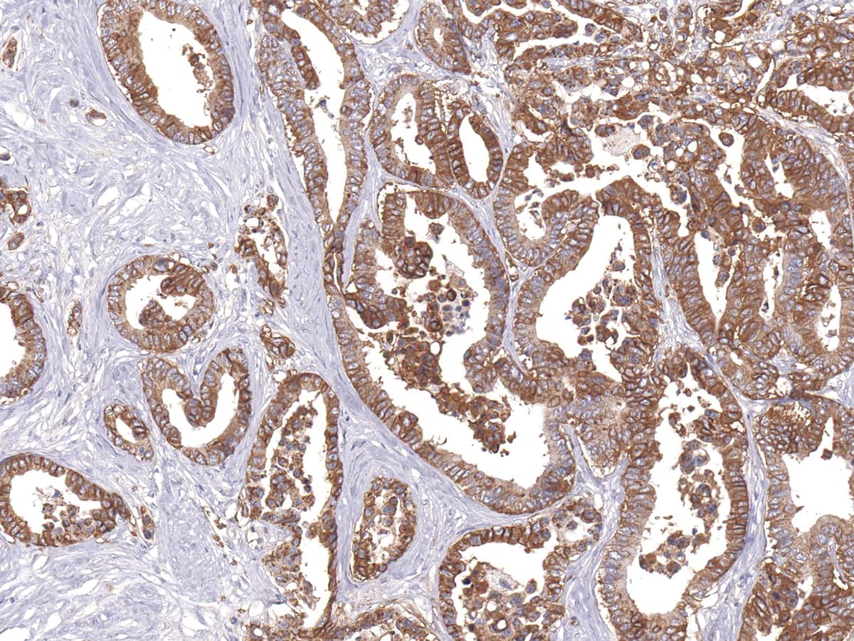 Monoclonal Mouse anti-Human SLC2A1 / GLUT-1 Antibody (Ready-to-Use, IHC)