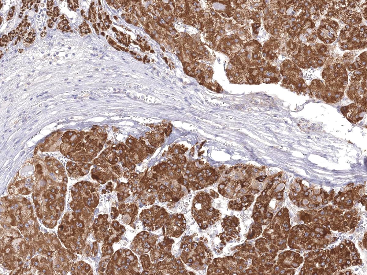 DOG1 Antibody (Concentrated)