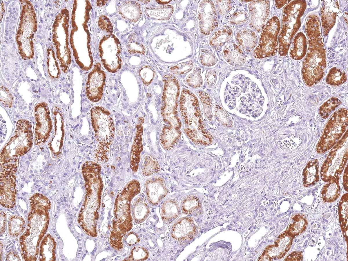NAPSA / NAPA / Napsin A Antibody (Ready-to-Use)