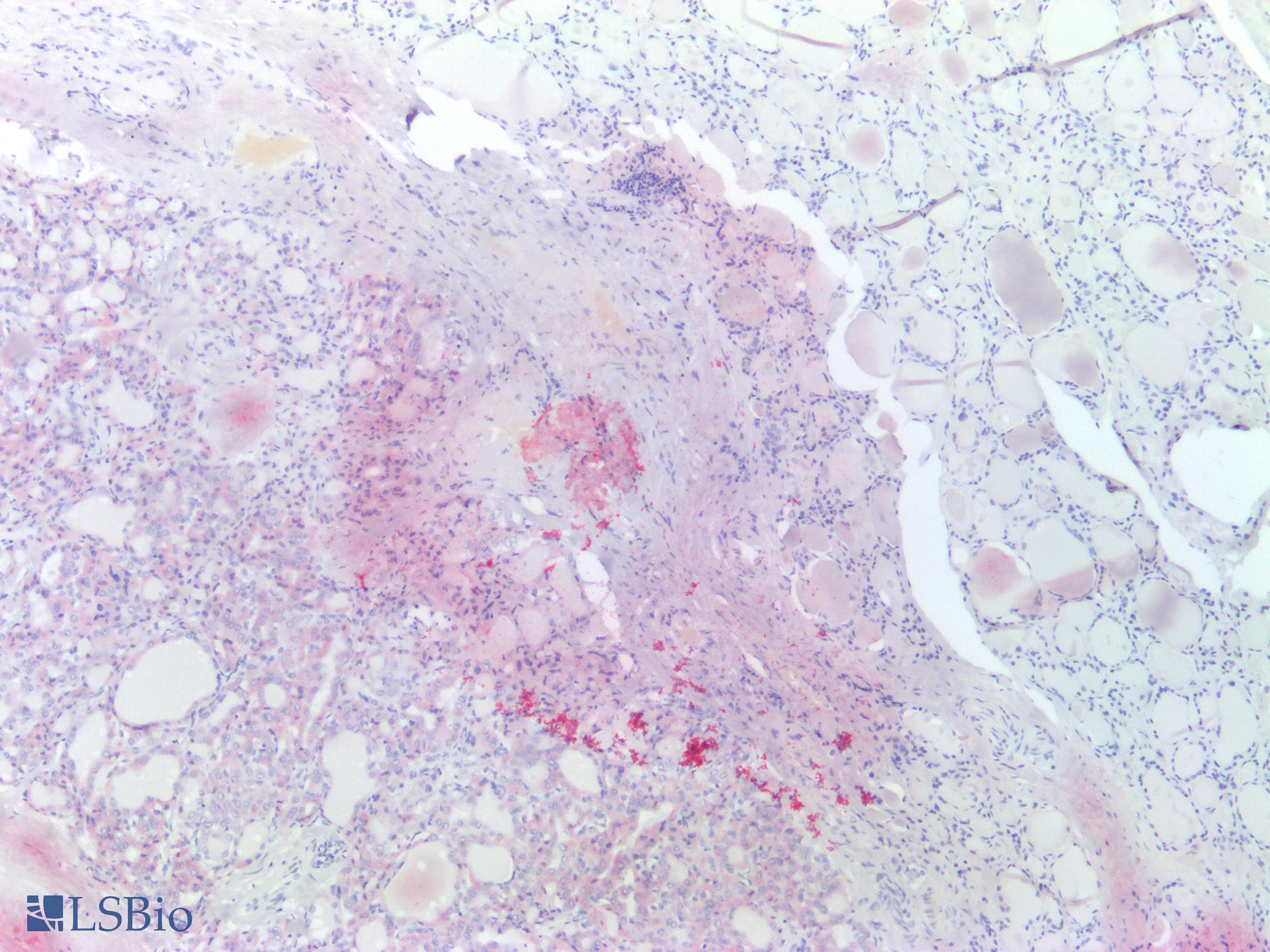 Recombinant Monoclonal Rabbit anti-Human BRAF / B-Raf Antibody (clone RM8, Ready-to-Use, Mutation V600E, IHC)