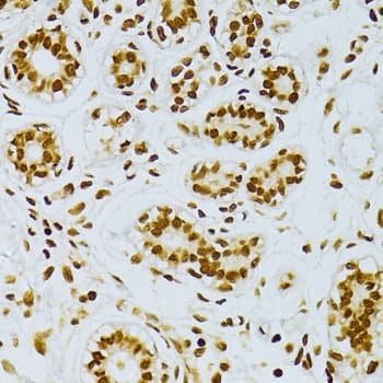 RELA / NFKB p65 Antibody (phospho-Ser276)