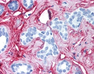 Polyclonal Rabbit anti-Human COL6A1 / Collagen VI Alpha 1 Antibody (IHC)