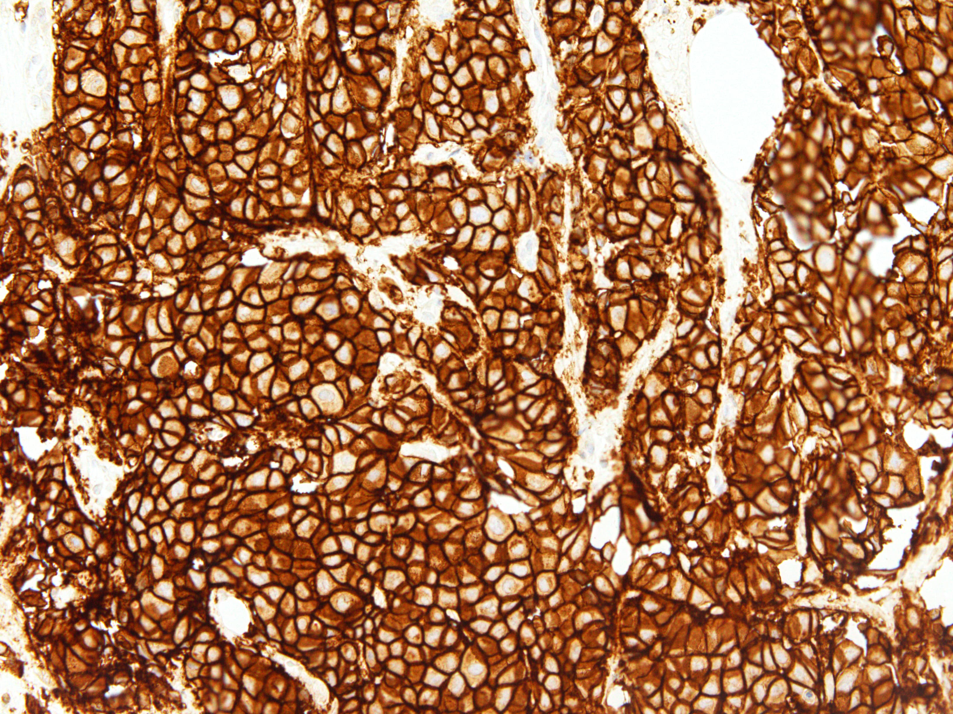 Monoclonal Mouse anti-Human ERBB2 / HER2 Antibody (Ready-to-Use, IHC)
