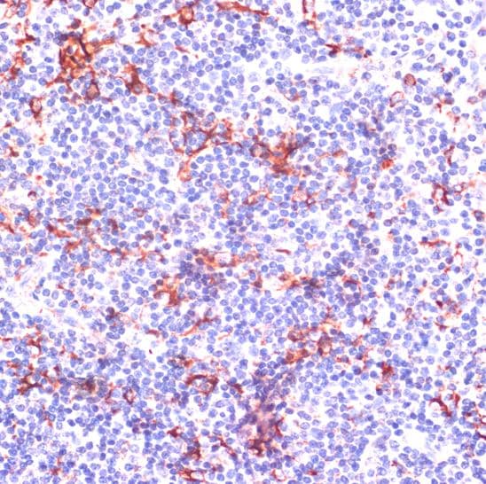 Polyclonal Rabbit anti-Human FUT4 / CD15 Antibody (IHC, WB)