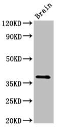 Polyclonal Rabbit anti-Rat Lumican Antibody