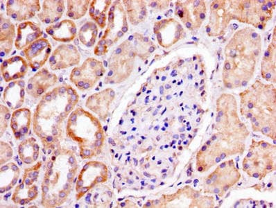 Polyclonal Rabbit anti-Human PHB / Prohibitin Antibody (IHC, WB)