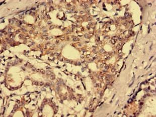 Polyclonal Rabbit anti-Human SFRP4 Antibody
