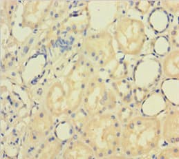 Polyclonal Rabbit anti-Human PAPPA / PAPP-A Antibody (WB)