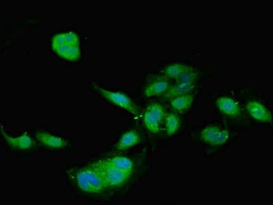 Polyclonal Rabbit anti-Human TIMP4 Antibody (IHC)