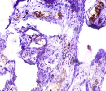 Polyclonal Rabbit anti-Human ICA69 / ICA1 Antibody (IHC, WB)