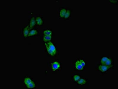 Polyclonal Rabbit anti-Human IL17RA Antibody