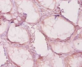 Polyclonal Rabbit anti-Human HDAC4 Antibody (IHC, WB)