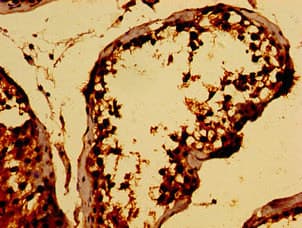 TCP10L Antibody