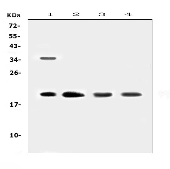 Polyclonal Rabbit anti-Human Dermatopontin / DPT Antibody (WB)