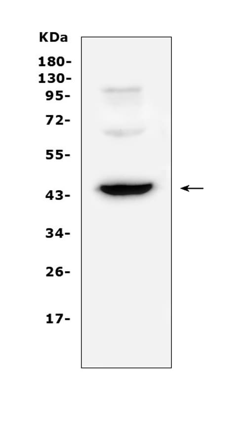 Polyclonal Rabbit anti-Human CD72 Antibody (WB)