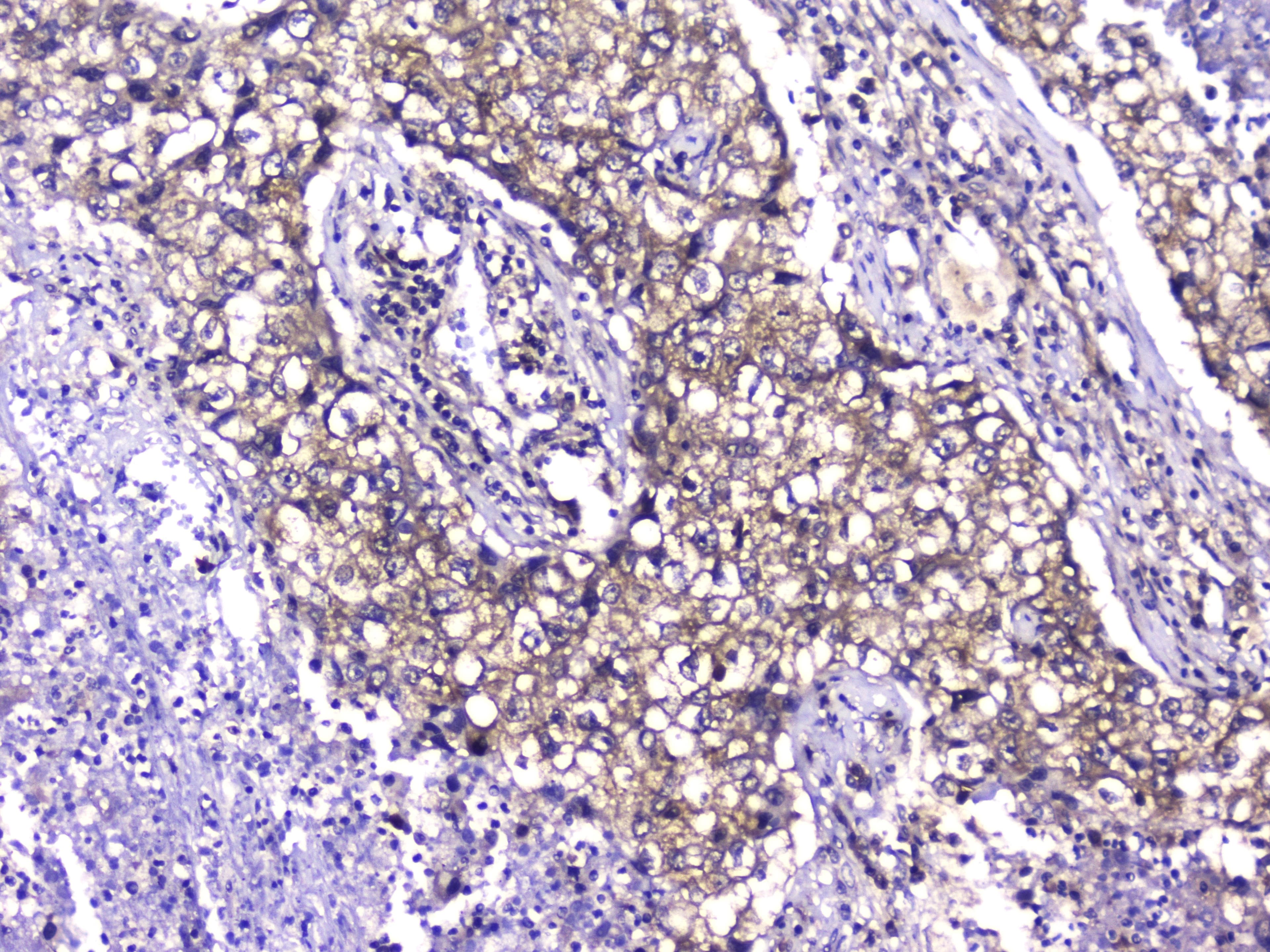 Monoclonal Mouse anti-Human TCP1 Antibody (IHC, WB)