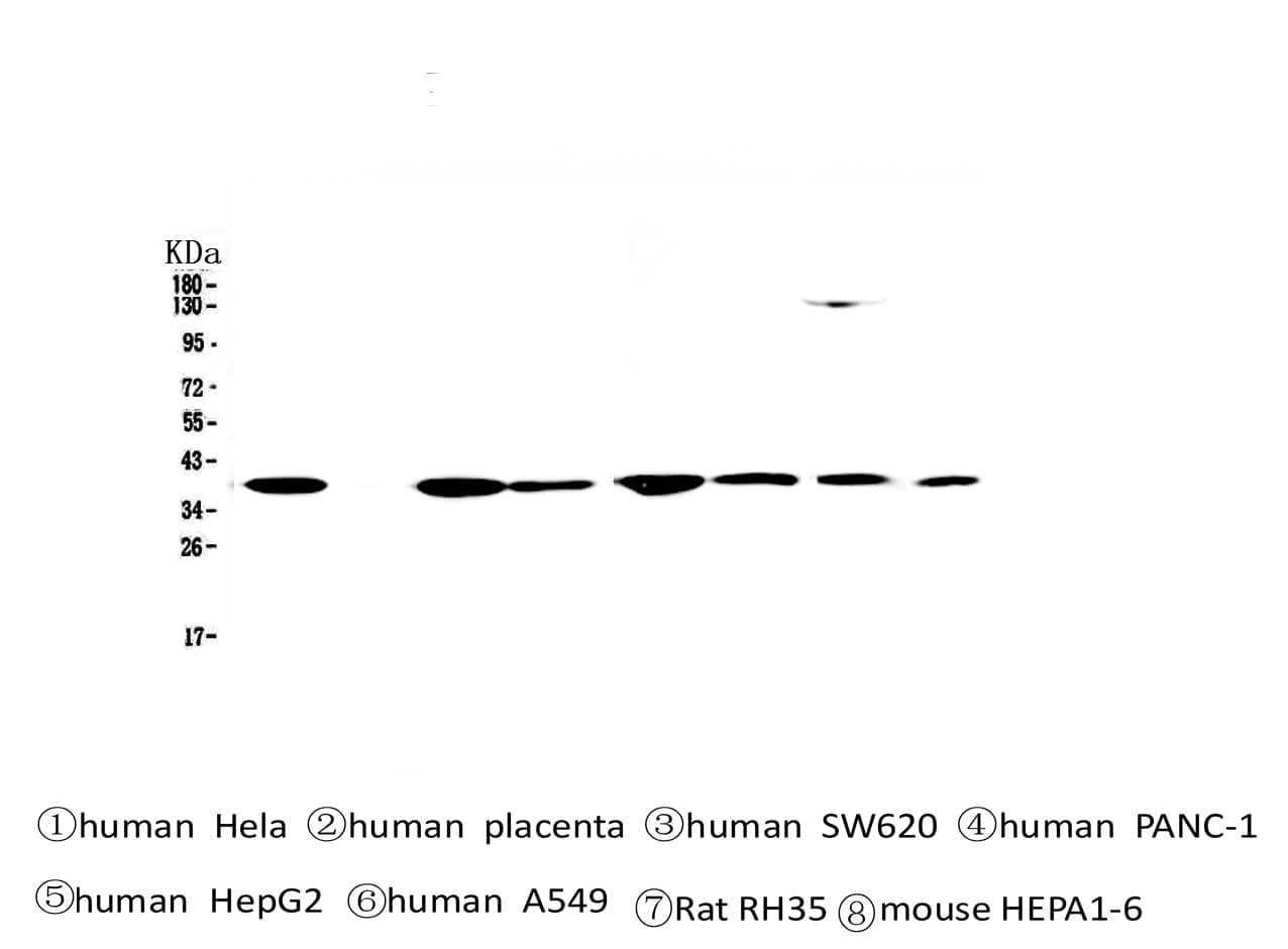 Monoclonal Mouse anti-Human SMN1 Antibody (IHC, WB)