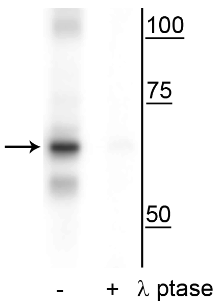 RELA / NFKB p65 Antibody (phospho-Ser316)
