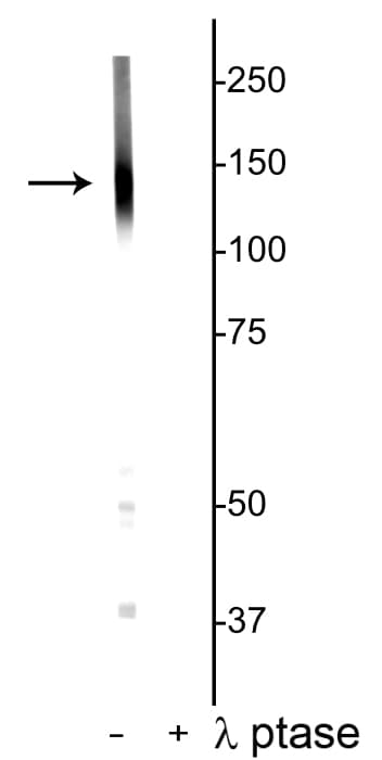 Polyclonal Rabbit anti-Mouse SLC12A5 / KCC2 Antibody (phospho-Ser940, WB)