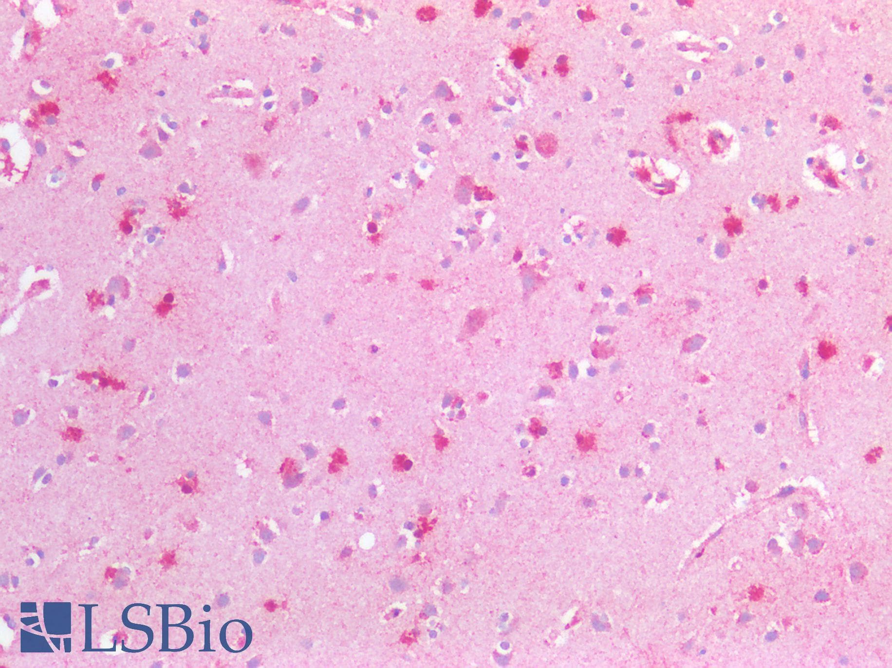 Metallothionein Antibody (N-Terminus)