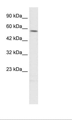 Polyclonal Rabbit anti-Human TPH2 Antibody (HRP, aa55-104, WB)