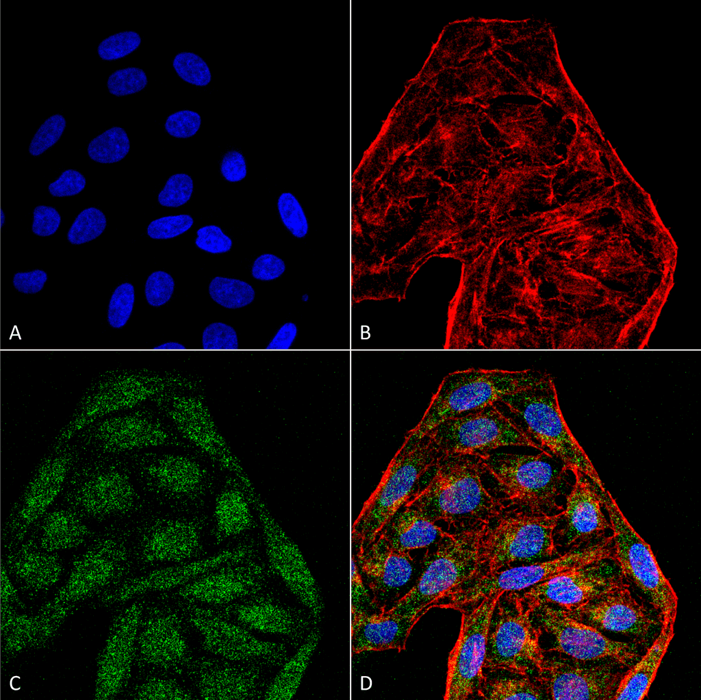 CD74 / CLIP Antibody (clone 6D9)