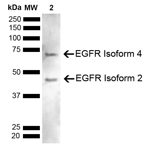 Polyclonal Rabbit anti-Human EGFR Antibody (Atto 594, WB)
