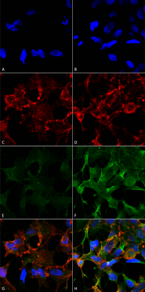 Monoclonal Mouse anti-All species Acrolein Antibody (clone 2H2, IF, WB)