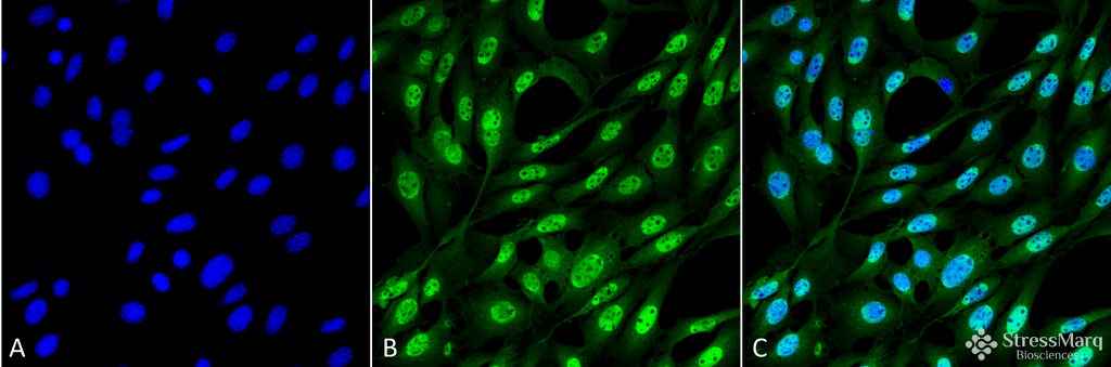 Ubiquitin Antibody (clone FK2)