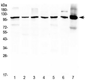 Polyclonal Rabbit anti-Human HDAC4 Antibody (WB)