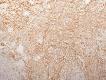 FN1 / Fibronectin Antibody (clone HFN7.1)