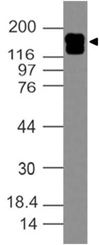 Polyclonal Rabbit anti-Human ERBB2 / HER2 Antibody (WB)