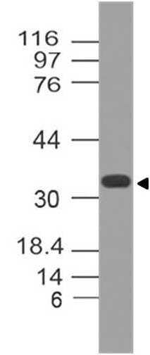 Polyclonal Rabbit anti-Human MTAP Antibody (WB)