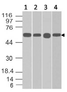 Monoclonal Mouse anti-Human ALDH1A1 / ALDH1 Antibody (WB)