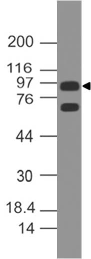 Monoclonal Mouse anti-Human AR / Androgen Receptor Antibody (WB)