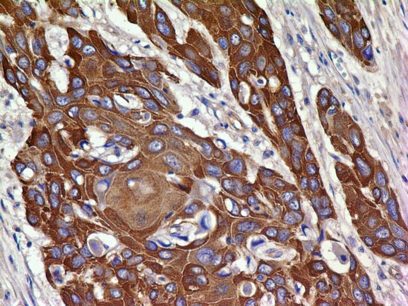 Monoclonal Mouse anti-Human KDR / VEGFR2 / FLK1 Antibody (IHC)