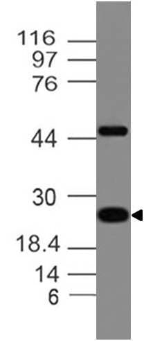 Monoclonal Mouse anti-Human Adiponectin Antibody (WB)