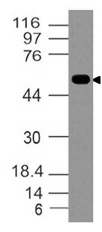 Polyclonal Rabbit anti-Human WNT5A Antibody (WB)