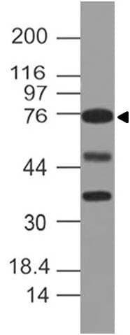 Polyclonal Rabbit anti-Human DLL4 Antibody (WB)