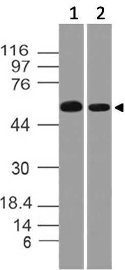 Polyclonal Rabbit anti-Mouse CAT / Catalase Antibody (WB)