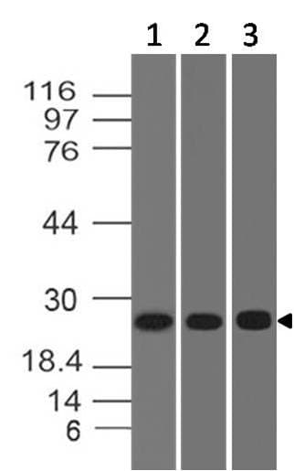 Polyclonal Rabbit anti-Human ERAS Antibody (WB)